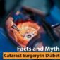 Facts and Myths about Cataract surgery in Diabetic patients